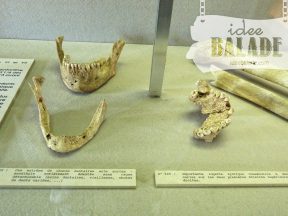 Mâchoires humaines.